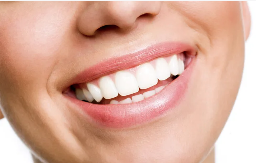 Teeth Whitening Services in Riyadh